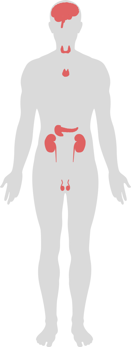 Body System Illustration